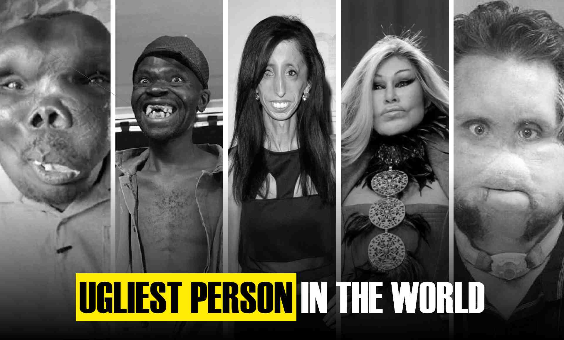 Ugliest Person in the World